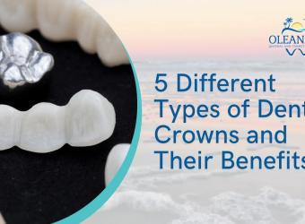 5 Different Types of Dental Crowns and Their Benefits