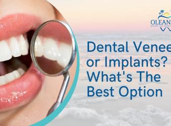 Dental Veneers or Implants? What&#039;s The Best Option